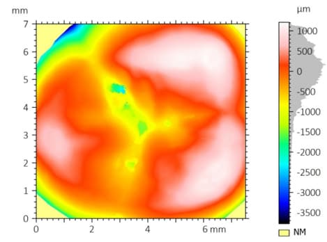 False-color surface topography map of full tooth crown measured with optical profilometer