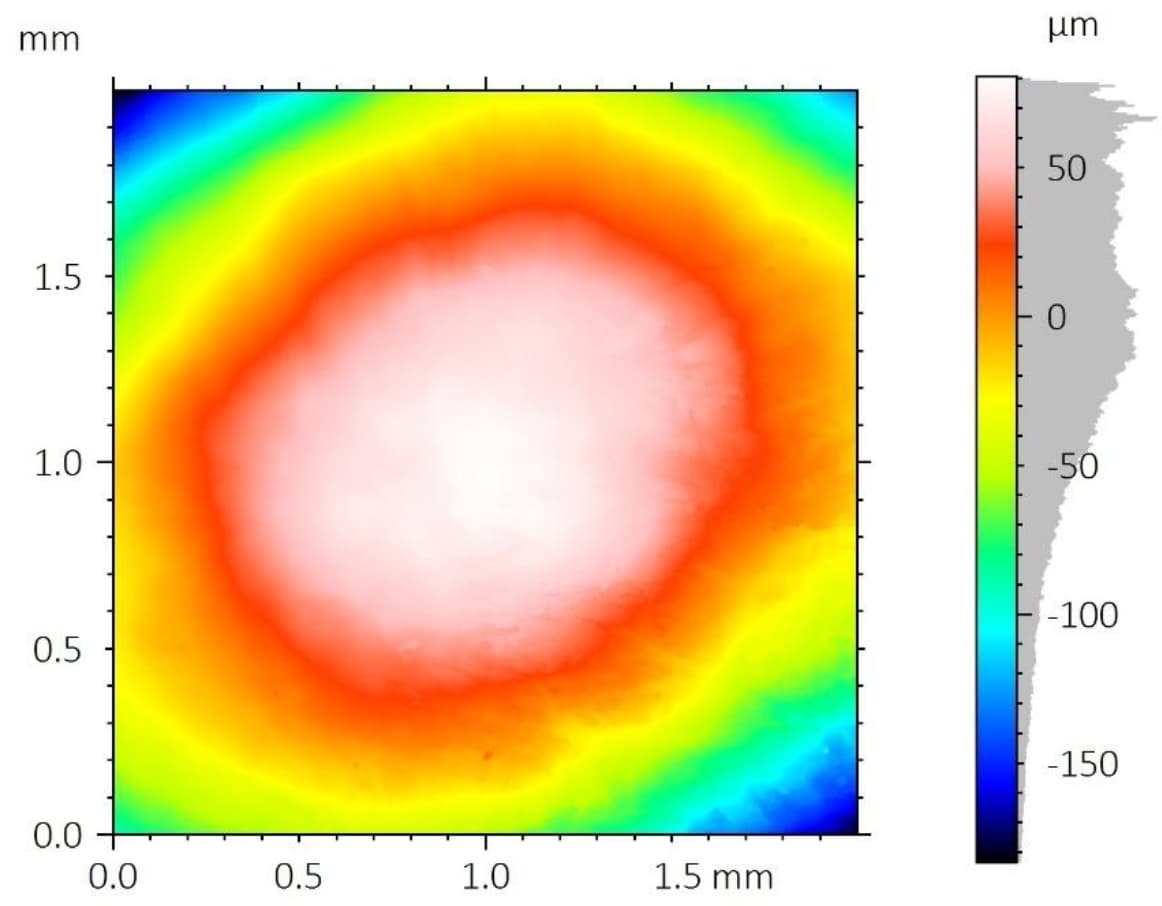 False-color 2D height map of scanned tooth surface region