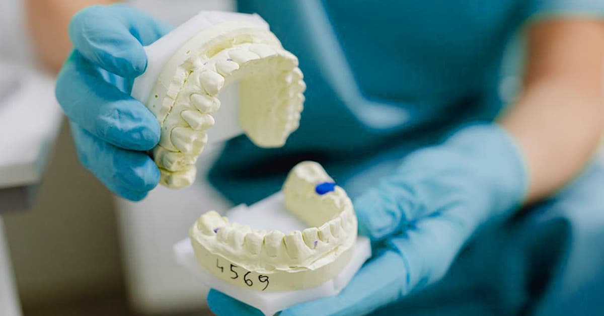 Dentist holding dental model for tooth surface roughness analysis and 3D reconstruction